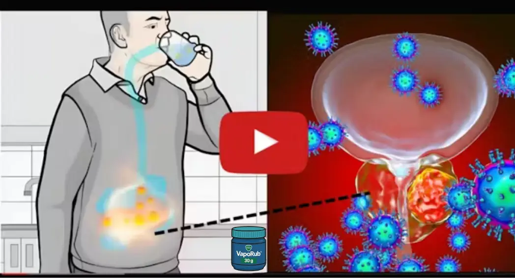 Watch presentation: nightly prostate reset